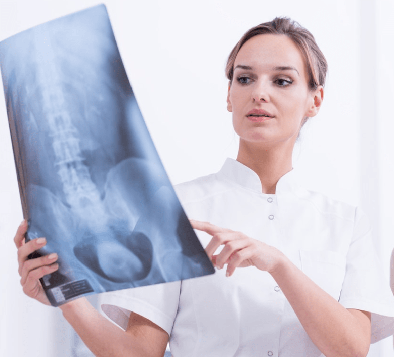 Diagnóstico de osteocondrosis torácica por examen de rayos X